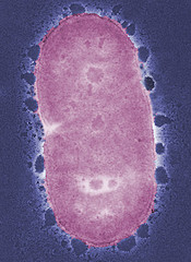 Porphyromonas gingivalis